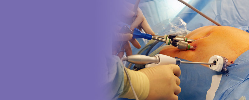 Bariatric surgery in thane